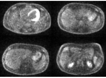 part2case3nucmed