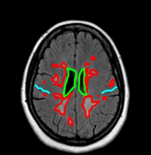 headFLAIR1lab