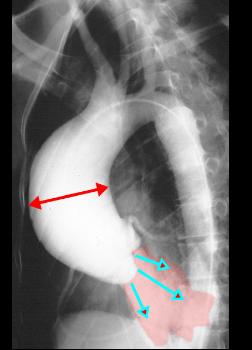 aortagramlab