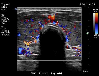 USTHYROID1102