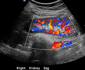 kidneyflow