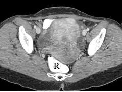 oralandrectal2