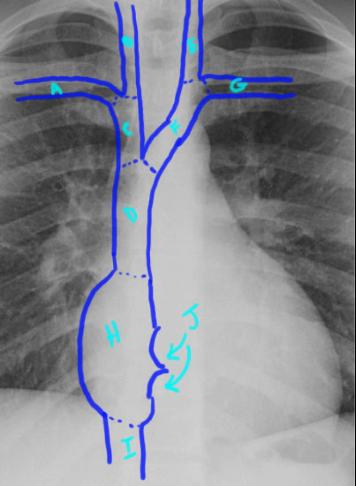 case1image3