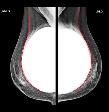 MLOviewslab